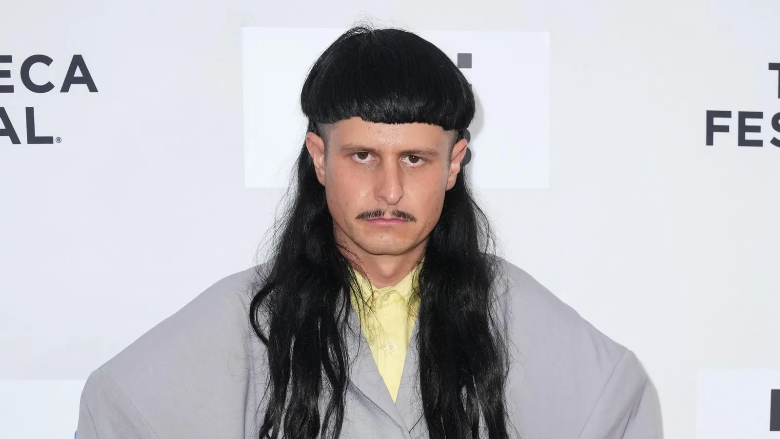 Oliver Tree, ‘Life Goes On’ And ‘Miss You’ Singer, Dies At 32