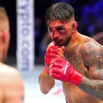 Ilia Topuria’s Gruesome Facial Injuries Revealed After Brutal TKO Loss
