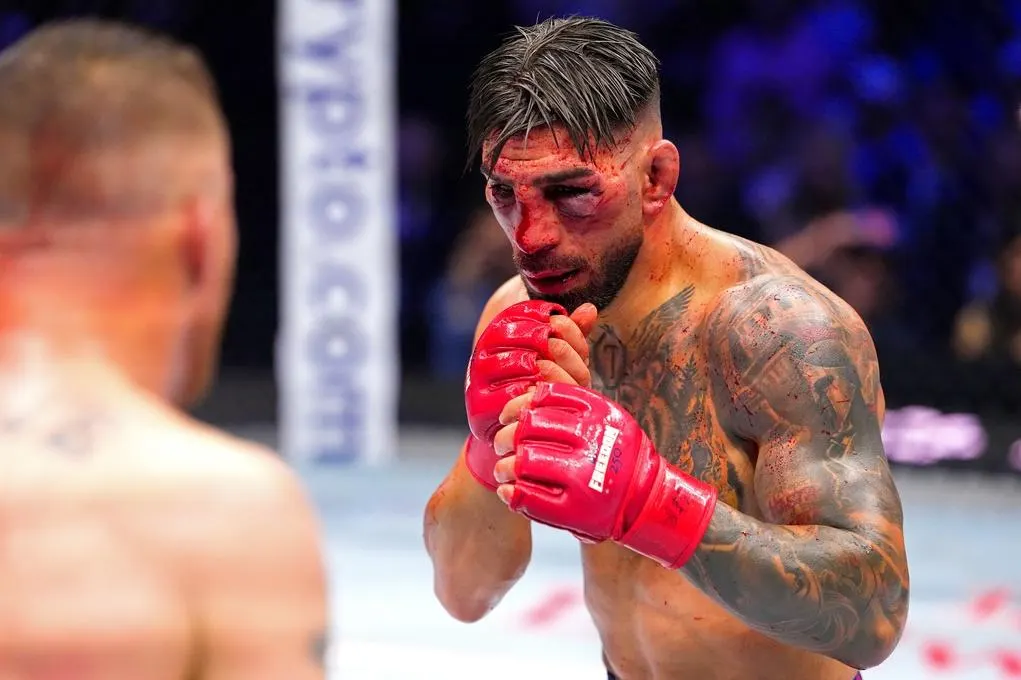 Ilia Topuria’s Gruesome Facial Injuries Revealed After Brutal TKO Loss