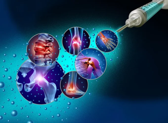 Regenerative Medicine In Spine And Joint Care