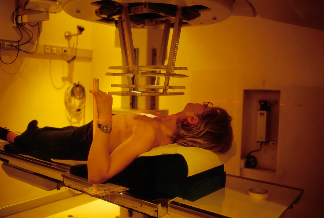 Medicare Coverage For DCIS Biomarker Tests And Radiation Decisions