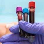 Galleri, The Blood Test That Can Detect Cancers, Is Up For FDA Approval Today