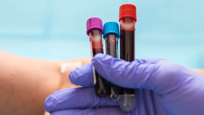 Galleri, The Blood Test That Can Detect Cancers, Is Up For FDA Approval Today